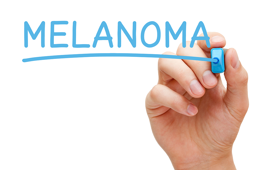 Predecir el riesgo de recaída de melanoma para mejorar la supervivencia